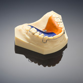The Objet Eden260VS Dental Advantage supports applications including stone models, surgical guides and veneers.