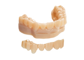 Diagnostic wax-ups produced with MED620 material on the Objet30 Dental Prime 3D Printer 