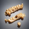 Hartgipsmodelle von Kronen und Brücken, gefertigt aus MED690 einem auf Objet30 Dental Prime 3D-Drucker